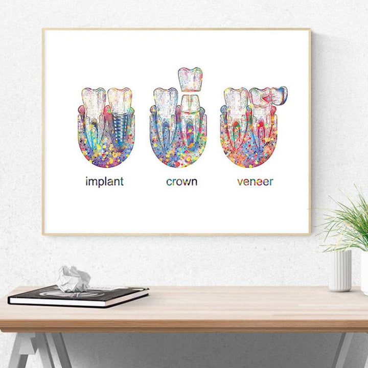 Cosmetic Dentistry Implant Crown Veneer Watercolour Print on 100% Cotton Canvas, beautifully illustrating dental implants and crowns, ideal for dental professionals and educators in cosmetic dentistry.