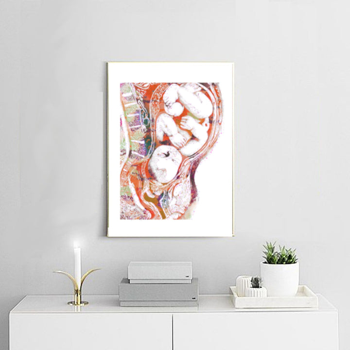 Pregnancy Full Term -Set of 3. 100% Cotton Canvas Watercolour Print