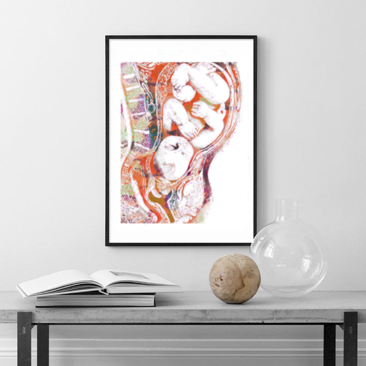 Pregnancy Full Term -Set of 3. 100% Cotton Canvas Watercolour Print